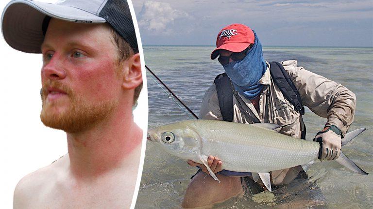 Photomontage: Left image Cutout of a man with a severely sunburned face. © Jonny Hunter, Attribution 2.0 Generic (CC BY 2.0), https://www.flickr.com/photos/jonnyhunter/3565036940/in/photostream/ Right image A flyfisher proudly displaying his catch. He is standing waist deep in salt water and he is wearing a High Uv Buff® as face mask. © Pat Ford